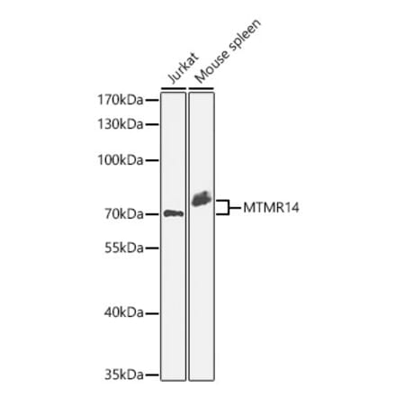 Western Blot - Anti-MTMR14 Antibody (A329650) - Antibodies.com