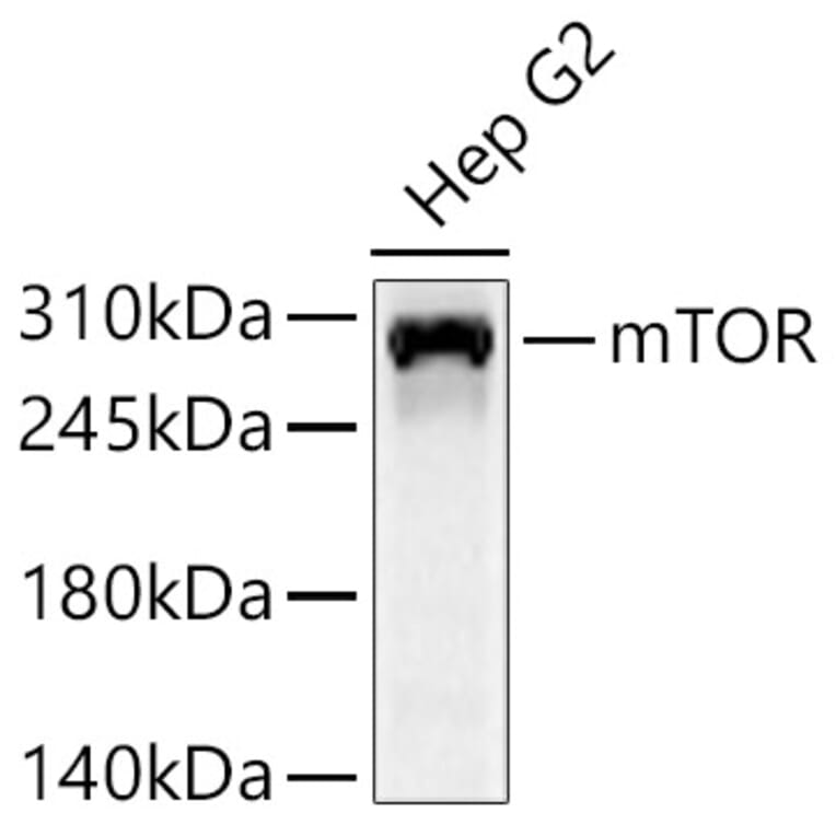 Western Blot - Anti-mTOR Antibody (A329651) - Antibodies.com
