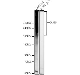 Western Blot - Anti-MUC16 Antibody (A329652) - Antibodies.com