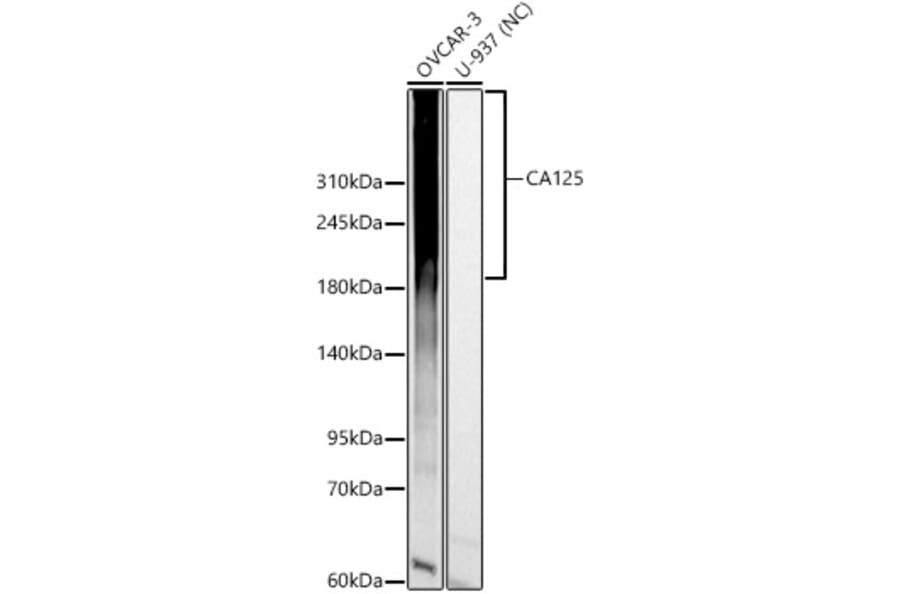 Western Blot - Anti-MUC16 Antibody (A329652) - Antibodies.com