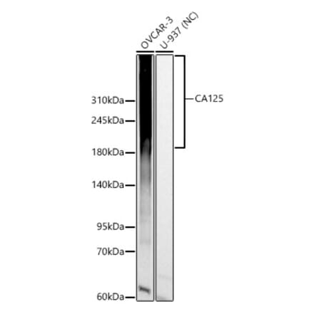 Western Blot - Anti-MUC16 Antibody (A329652) - Antibodies.com