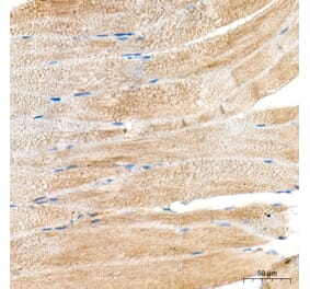 Immunohistochemistry - Anti-MYH6 Antibody (A329655) - Antibodies.com