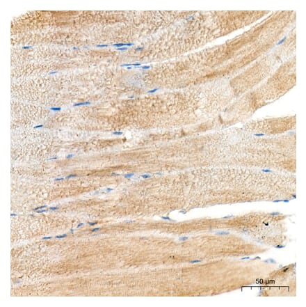 Immunohistochemistry - Anti-MYH6 Antibody (A329655) - Antibodies.com