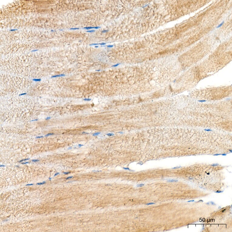 Immunohistochemistry - Anti-MYH6 Antibody (A329655) - Antibodies.com