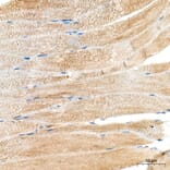 Immunohistochemistry - Anti-MYH6 Antibody (A329655) - Antibodies.com