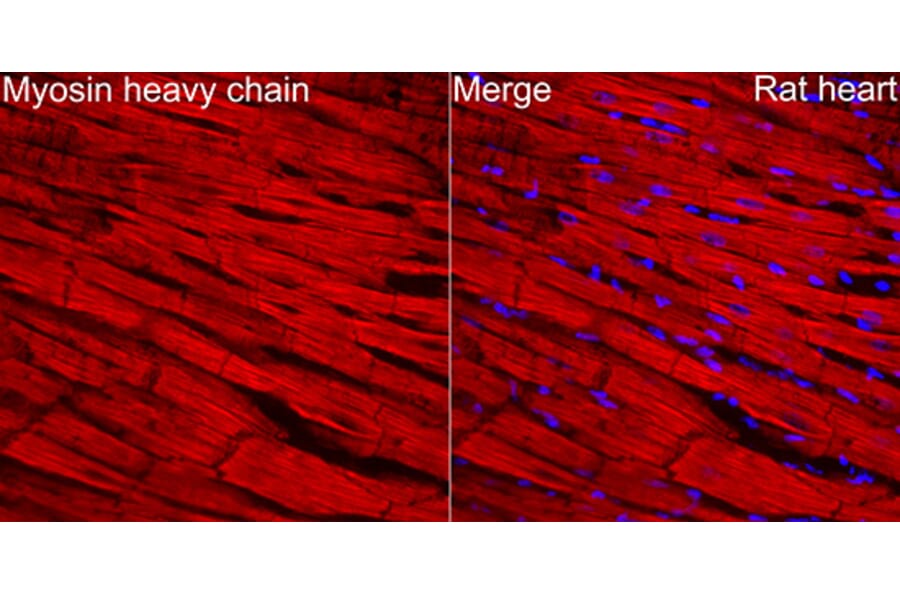 Immunofluorescence - Anti-MYH6 Antibody (A329655) - Antibodies.com