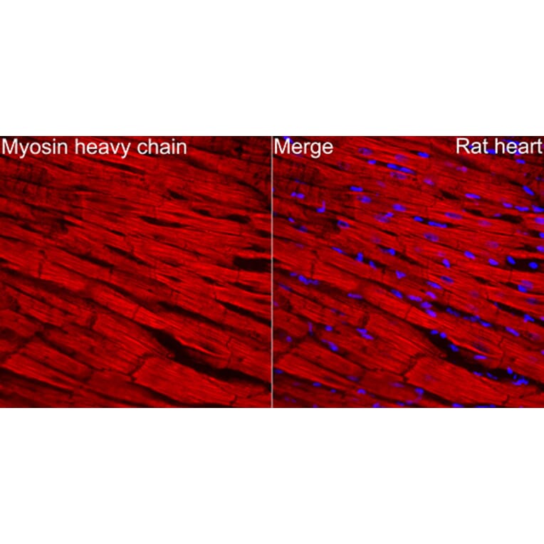 Immunofluorescence - Anti-MYH6 Antibody (A329655) - Antibodies.com