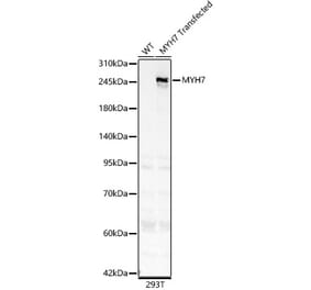 Western Blot - Anti-MYH7 Antibody (A329656) - Antibodies.com