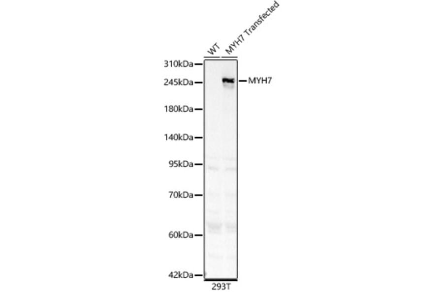 Western Blot - Anti-MYH7 Antibody (A329656) - Antibodies.com