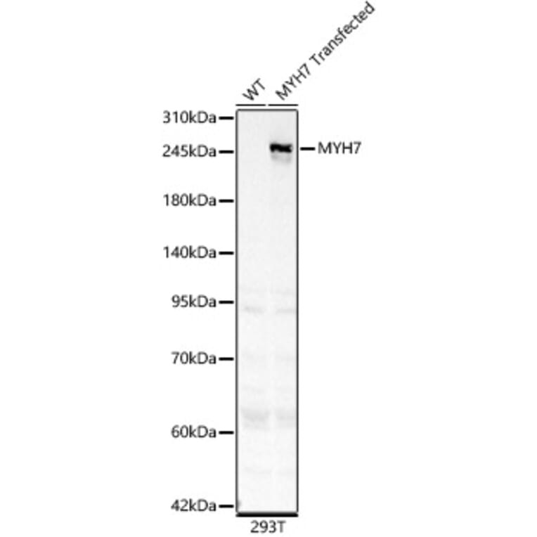 Western Blot - Anti-MYH7 Antibody (A329656) - Antibodies.com