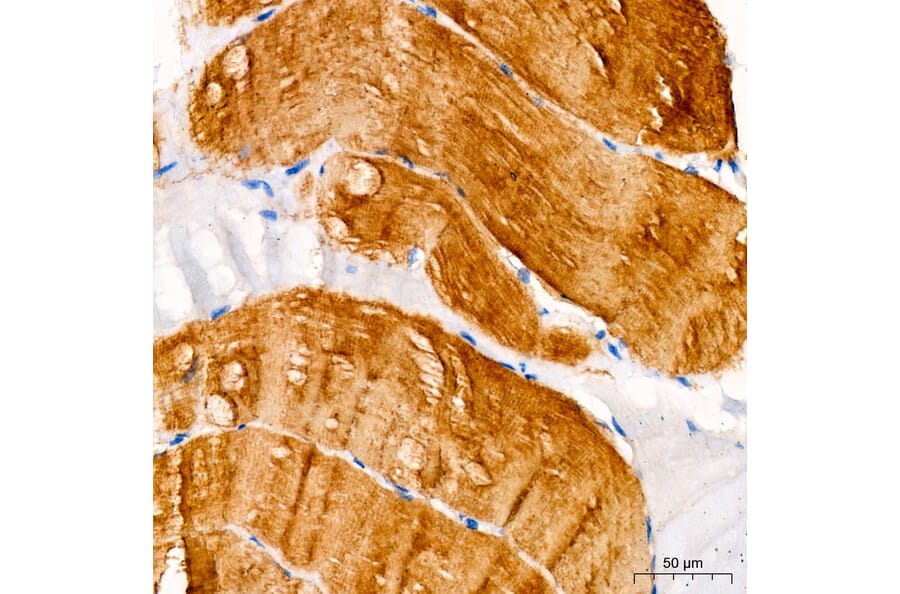Immunohistochemistry - Anti-MYH7 Antibody (A329656) - Antibodies.com
