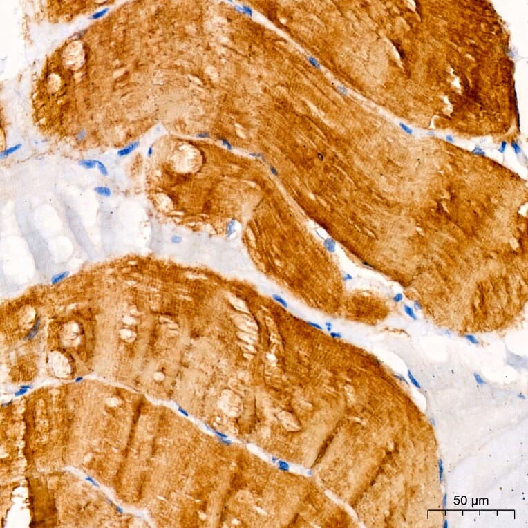 Immunohistochemistry - Anti-MYH7 Antibody (A329656) - Antibodies.com