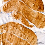 Immunohistochemistry - Anti-MYH7 Antibody (A329656) - Antibodies.com