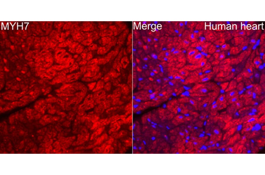 Immunofluorescence - Anti-MYH7 Antibody (A329656) - Antibodies.com
