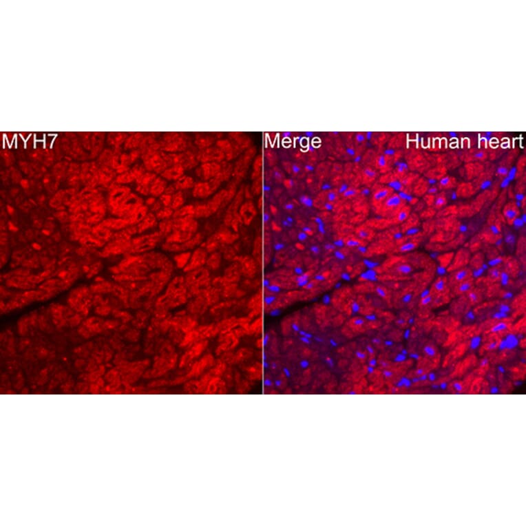 Immunofluorescence - Anti-MYH7 Antibody (A329656) - Antibodies.com