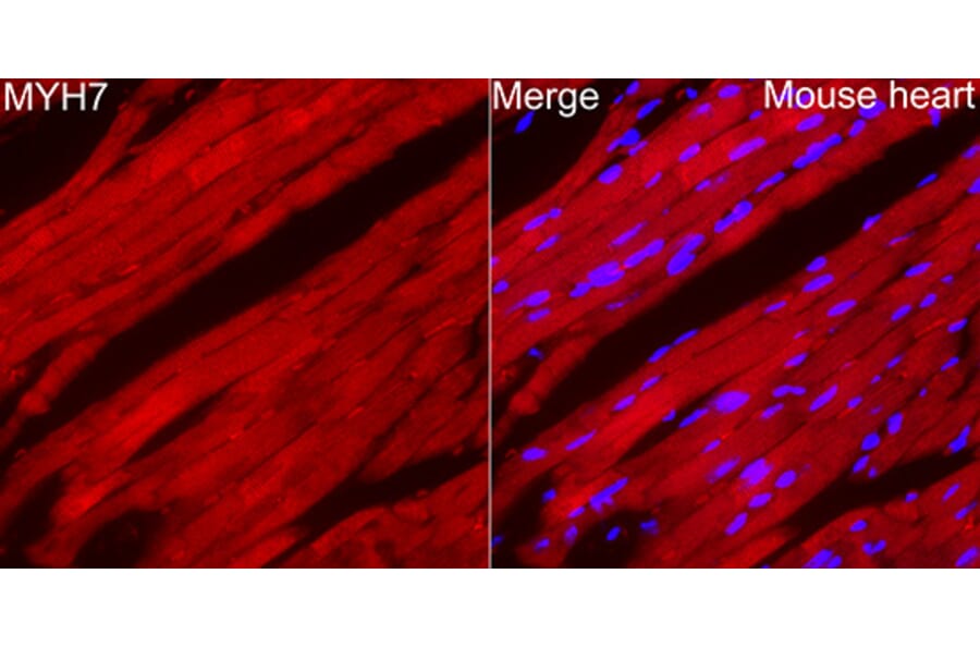 Immunofluorescence - Anti-MYH7 Antibody (A329656) - Antibodies.com