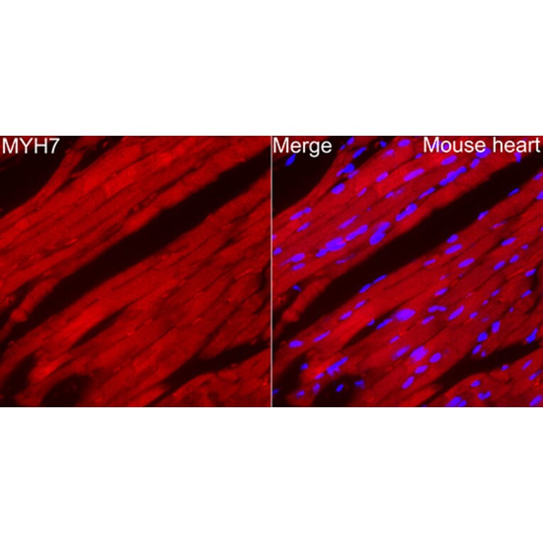 Immunofluorescence - Anti-MYH7 Antibody (A329656) - Antibodies.com