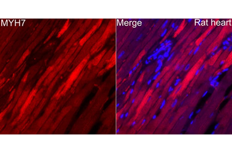 Immunofluorescence - Anti-MYH7 Antibody (A329656) - Antibodies.com