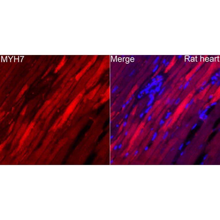 Immunofluorescence - Anti-MYH7 Antibody (A329656) - Antibodies.com