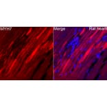 Immunofluorescence - Anti-MYH7 Antibody (A329656) - Antibodies.com