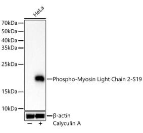 Western Blot - Anti-MYL9 (Phospho S19) Antibody [ARC62046] (A329657) - Antibodies.com