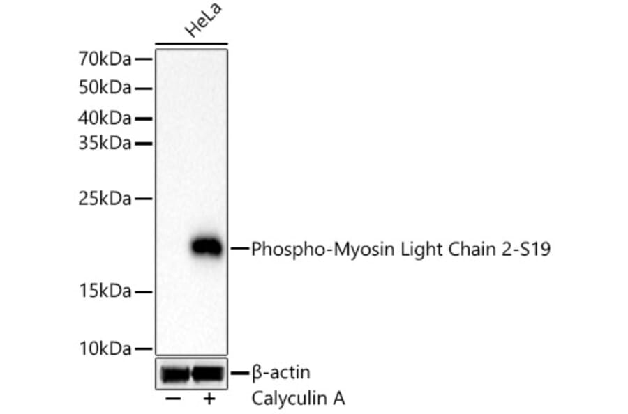 Western Blot - Anti-MYL9 (Phospho S19) Antibody [ARC62046] (A329657) - Antibodies.com