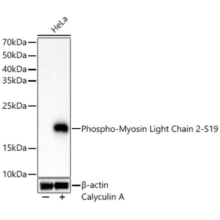 Western Blot - Anti-MYL9 (Phospho S19) Antibody [ARC62046] (A329657) - Antibodies.com