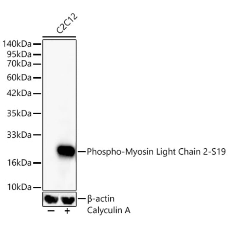 Western Blot - Anti-MYL9 (Phospho S19) Antibody [ARC62046] (A329657) - Antibodies.com