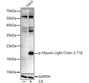 Western Blot - Anti-MYL9 (Phospho T18) Antibody [ARC62064] (A329658) - Antibodies.com