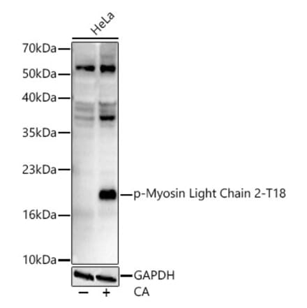 Western Blot - Anti-MYL9 (Phospho T18) Antibody [ARC62064] (A329658) - Antibodies.com