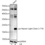 Western Blot - Anti-MYL9 (Phospho T18) Antibody [ARC62064] (A329658) - Antibodies.com
