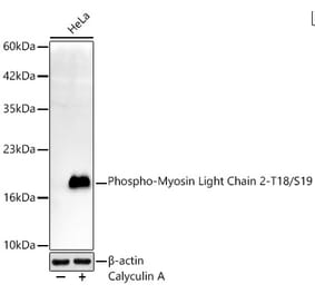 Western Blot - Anti-MYL9 (Phospho T18/S19) Antibody [ARC62066] (A329659) - Antibodies.com