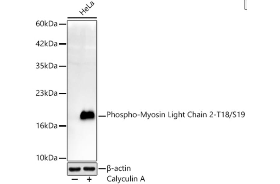 Western Blot - Anti-MYL9 (Phospho T18/S19) Antibody [ARC62066] (A329659) - Antibodies.com