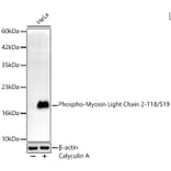 Western Blot - Anti-MYL9 (Phospho T18/S19) Antibody [ARC62066] (A329659) - Antibodies.com