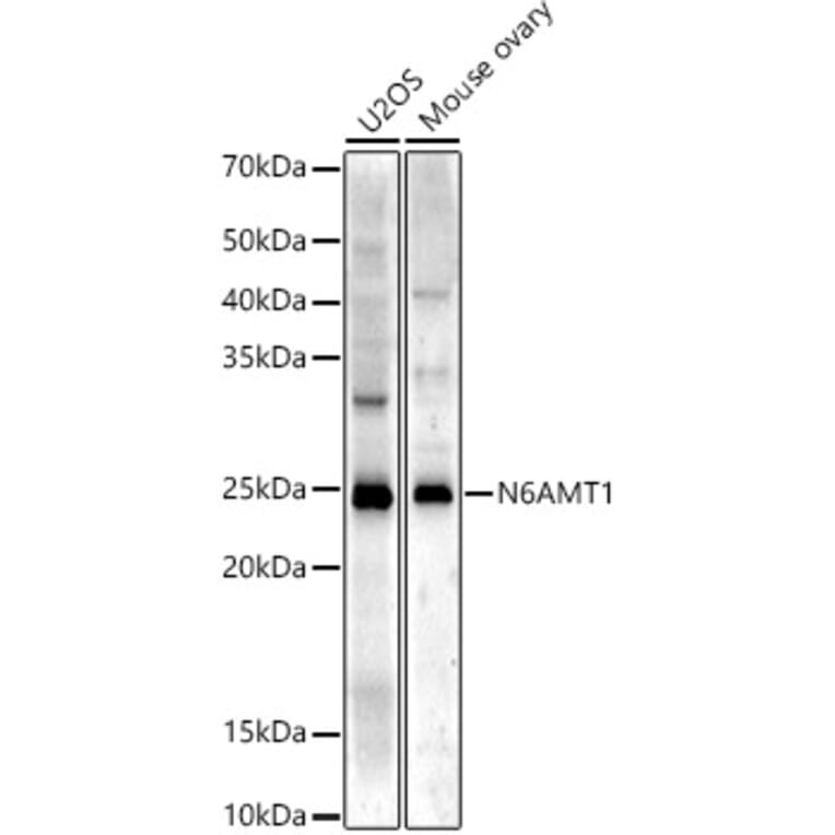 Western Blot - Anti-N6AMT1 Antibody (A329660) - Antibodies.com