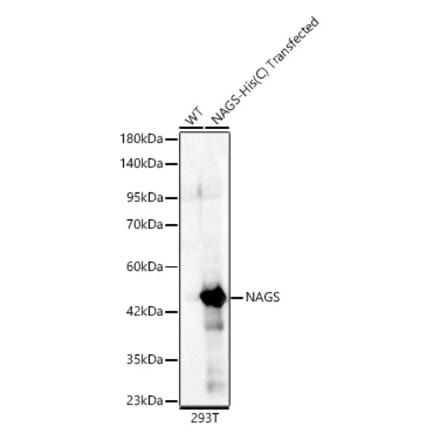 Western Blot - Anti-NAGS Antibody (A329661) - Antibodies.com