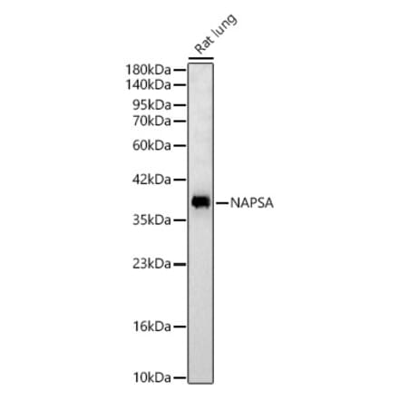 Western Blot - Anti-Napsin A Antibody (A329662) - Antibodies.com