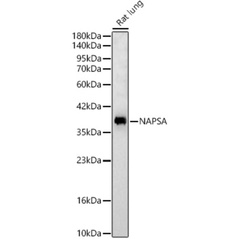 Western Blot - Anti-Napsin A Antibody (A329662) - Antibodies.com