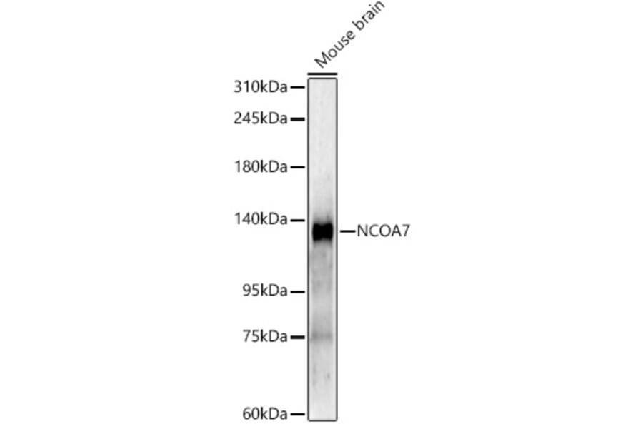 Western Blot - Anti-NCOA7 Antibody [ARC61925] (A329663) - Antibodies.com