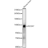 Western Blot - Anti-NCOA7 Antibody [ARC61925] (A329663) - Antibodies.com