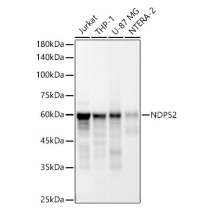 Western Blot - Anti-NDP52 Antibody [ARC54603] (A329664) - Antibodies.com