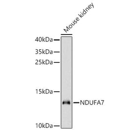 Western Blot - Anti-NDUFA7 Antibody (A329665) - Antibodies.com