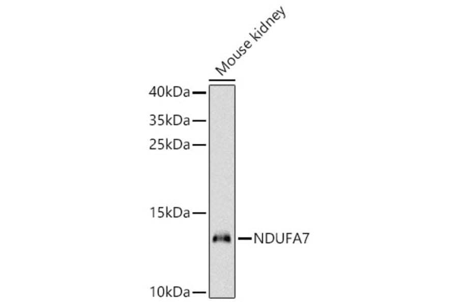 Western Blot - Anti-NDUFA7 Antibody (A329665) - Antibodies.com