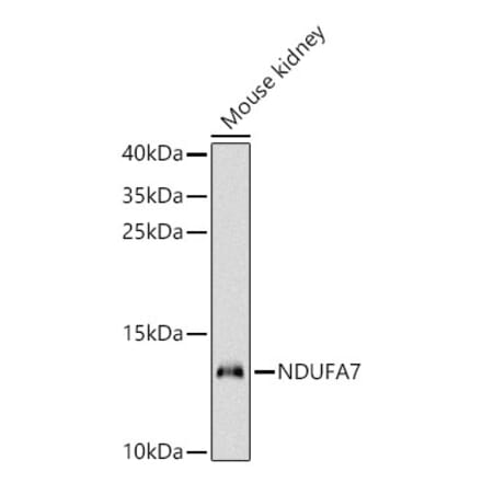 Western Blot - Anti-NDUFA7 Antibody (A329665) - Antibodies.com