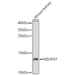 Western Blot - Anti-NDUFA7 Antibody (A329665) - Antibodies.com