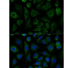 Immunofluorescence - Anti-NDUFAB1 Antibody (A329666) - Antibodies.com