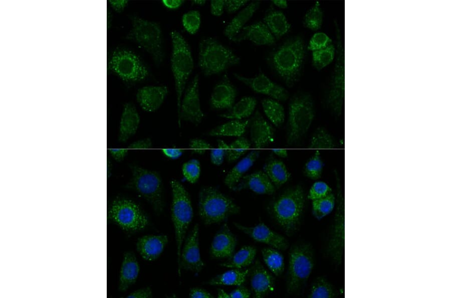 Immunofluorescence - Anti-NDUFAB1 Antibody (A329666) - Antibodies.com