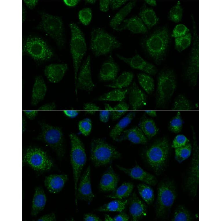 Immunofluorescence - Anti-NDUFAB1 Antibody (A329666) - Antibodies.com