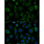 Immunofluorescence - Anti-NDUFAB1 Antibody (A329666) - Antibodies.com
