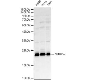 Western Blot - Anti-NDUFS7 Antibody (A329667) - Antibodies.com